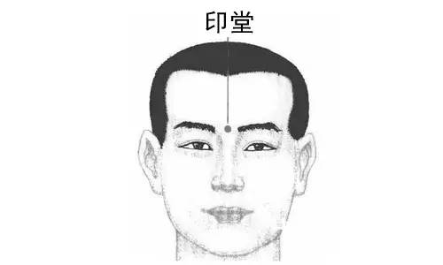 印堂穴