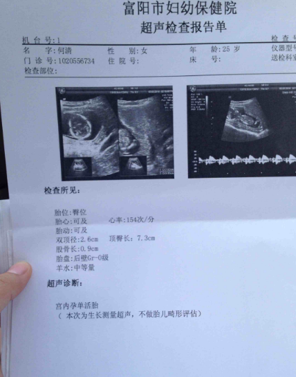 B超单上就能看出男女性别，宝妈们，你们有多少人知道看？