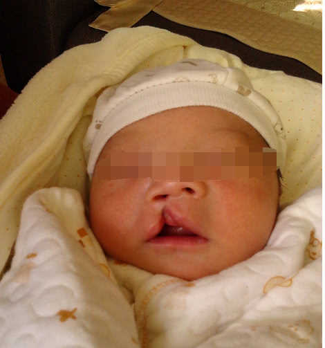 23岁孕妇早产生下畸形儿，看到孩子后，老公跪地大哭:造孽呀!