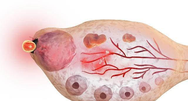 女人在排卵期,如果有这3种感觉,怀孕的几率可