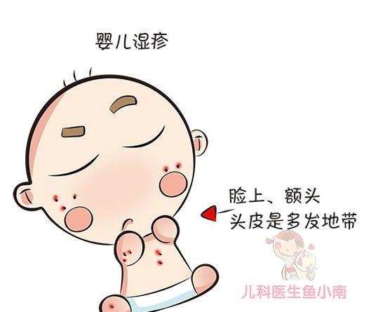 宝宝湿疹热疹都是"疹"?看完医生的剖析,爸妈不再傻傻分不清