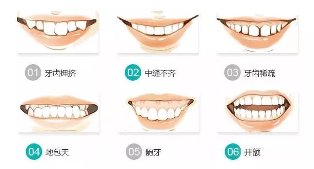 牙齿矫正错过了最佳年龄,28岁、38岁…一样可
