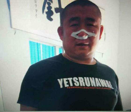 生活中常吃的白萝卜可以治鼻炎,3天就见效,1月