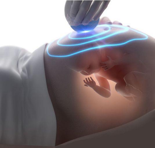 四维彩超主要检查什么?