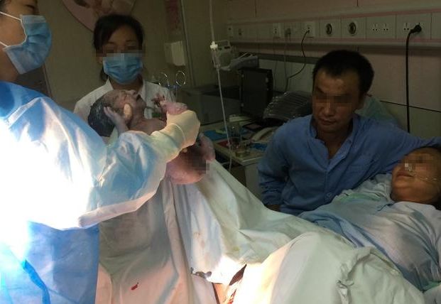三十岁女子顺产永远睡在了手术台上,一尸两命,只因为