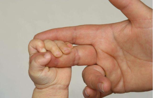 梦见大拇指旁边多生大母指,周公解梦与深层含义探析 梦见大拇指旁边多生大母指,周公解梦与深层含义探析