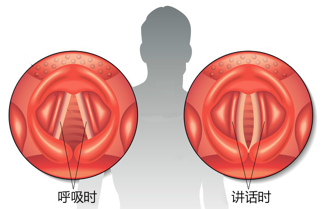 K歌嗓子哑了怎么办怎样快速恢复,值得收藏的