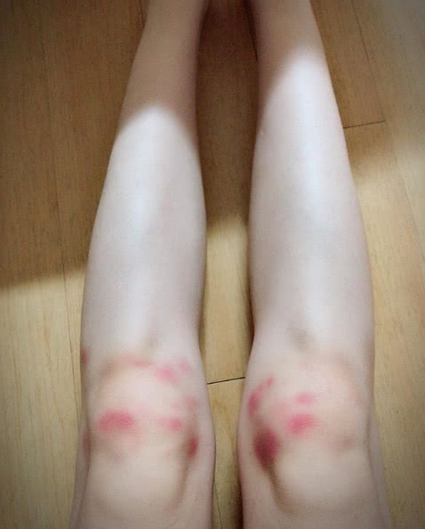 健身女神日常晒照,膝盖淤青引人注目,网友:太俏皮!