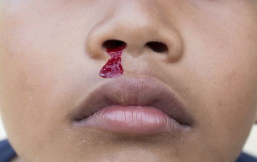 唇色深什么原因?原来嘴唇的颜色决着定你的健