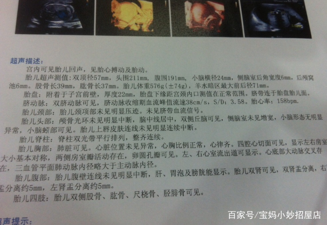 b超单上3个数据,或许暗示胎儿性别