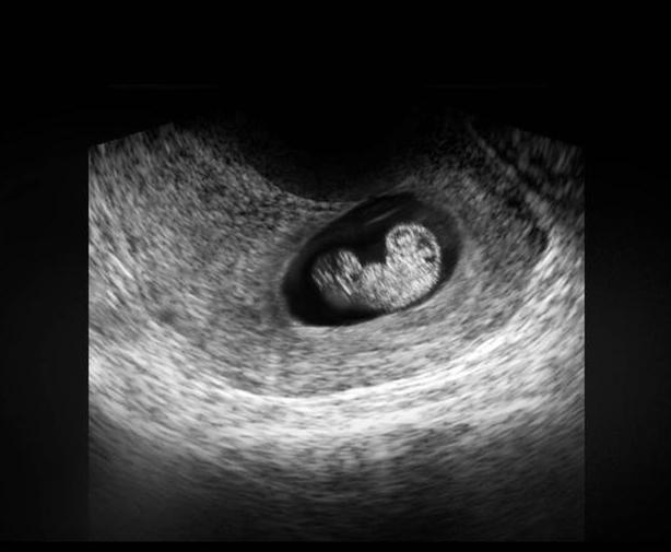 胎儿从卵泡到性别形成,17张图片清晰诠释,男宝