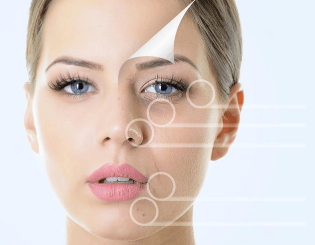 梅梅护肤老师: 激素脸修复中为什么会有脱皮现象是否为正常现象?