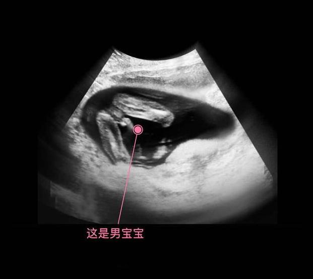 胎儿从卵泡到性别形成,17张图片清晰诠释,男宝