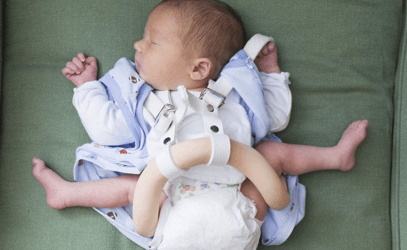 3岁宝宝走路一瘸一拐, 只因小时候父母这个方