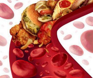 六个因素就是导致尿酸升高,引发痛风的罪魁祸