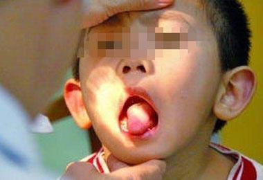 男孩三岁还不会说话, 张开嘴巴后, 医生都蒙圈了