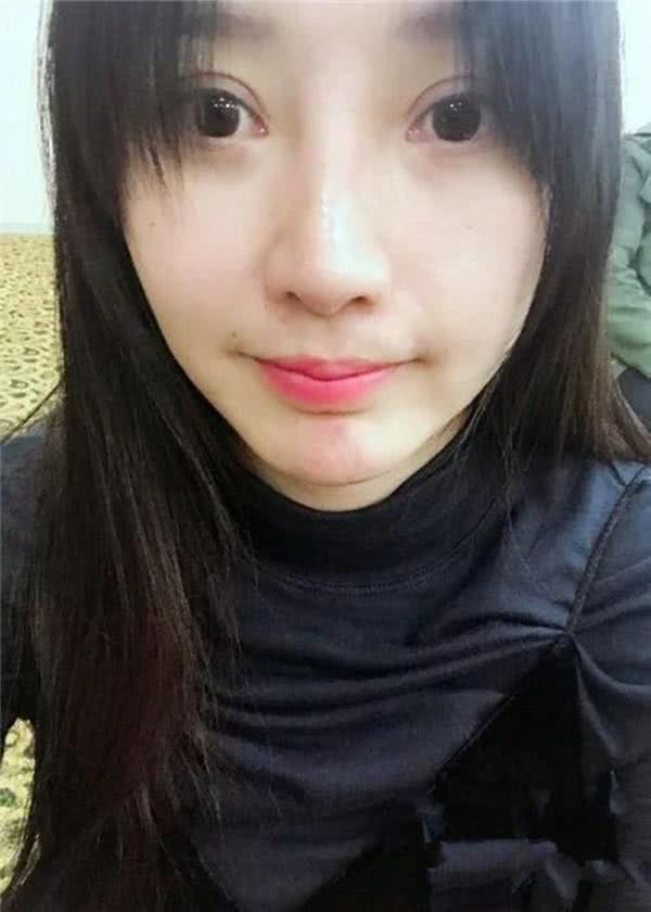 柳岩曝割了双眼皮后照片，这褶子太明显了！还劝女性不要去整容！