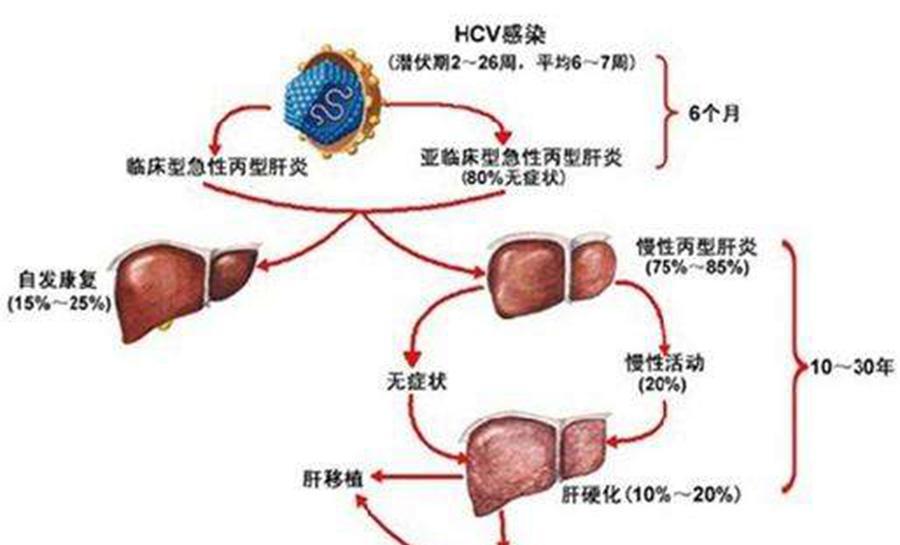 丙肝治疗方案 你知道吗