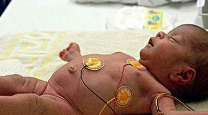 婴儿吃完饭为什么一定要拍嗝, 这些结果你无法