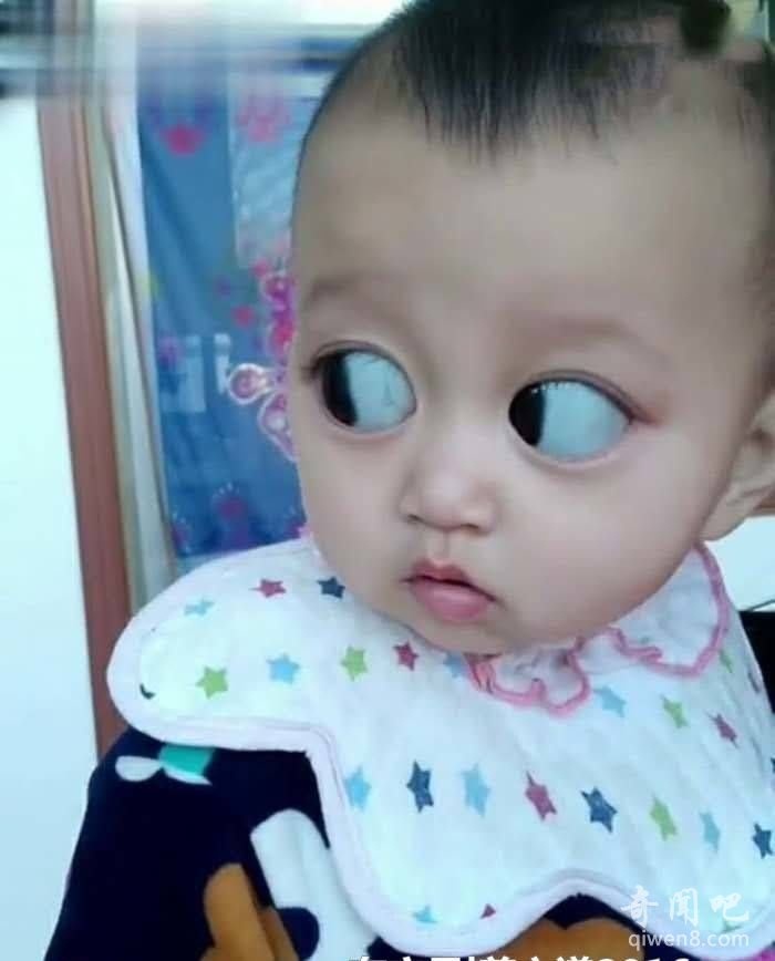 女子怀孕期间天天吃黑葡萄,结果孩子出生那刻