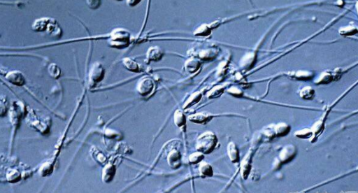 人类以前是生活在水下,和海豚类似?人类是祖先