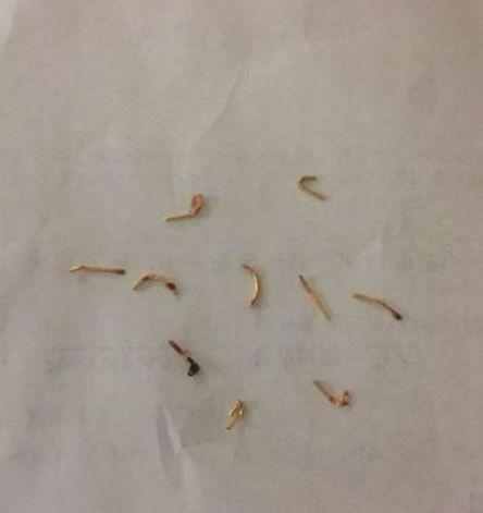 感到疼痛不已,去医院检查之后,真相让他气愤!