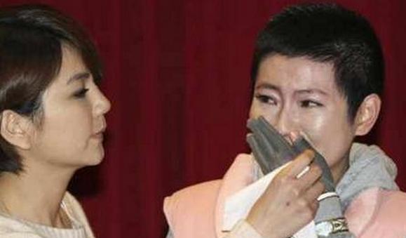 she的selina任家萱经过7年不断整容, 疤痕修复越来越好