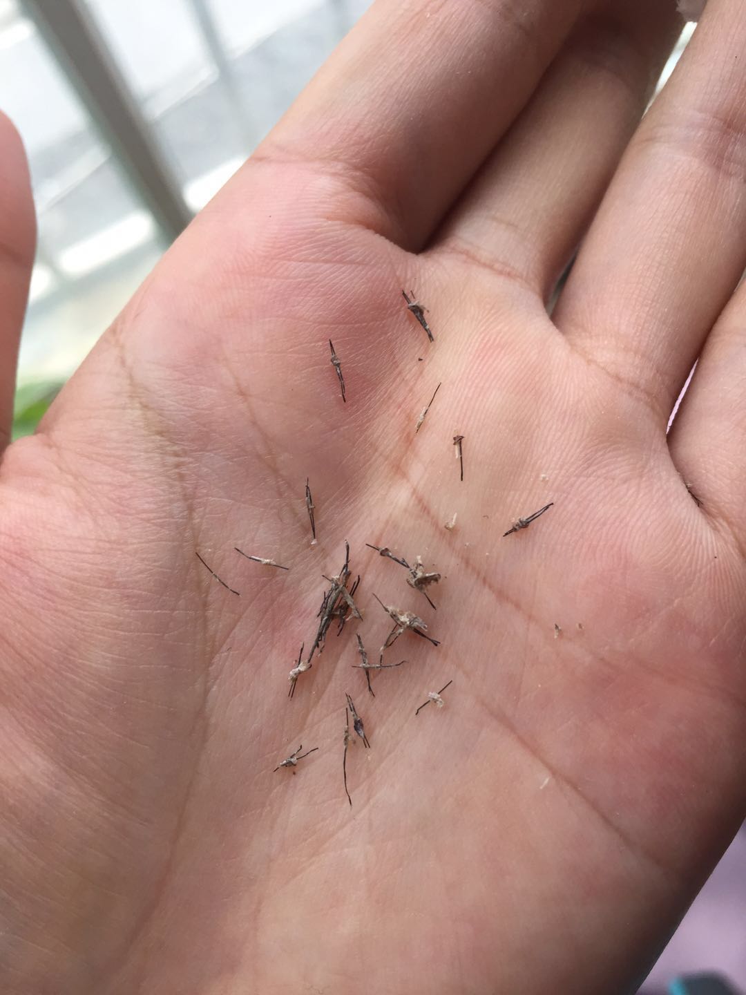 植发以后头发掉光了,怎么办?