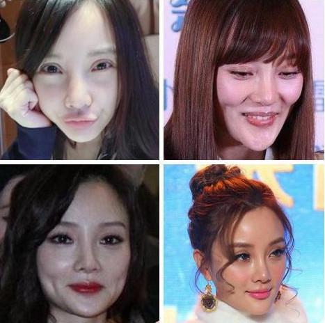 李小璐硬生生的将一个靓丽少女“换脸”变成了一个僵尸脸小姐姐！