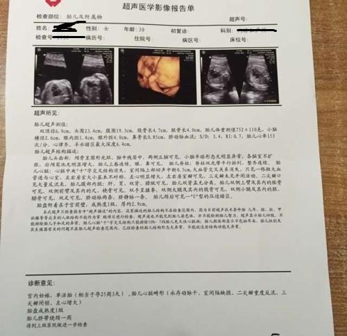 孕妈什么时候开始排除胎儿畸形?过了这个危险