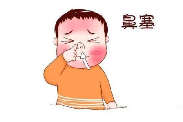 过敏性鼻炎有哪些症状?该如何缓解这些症状?