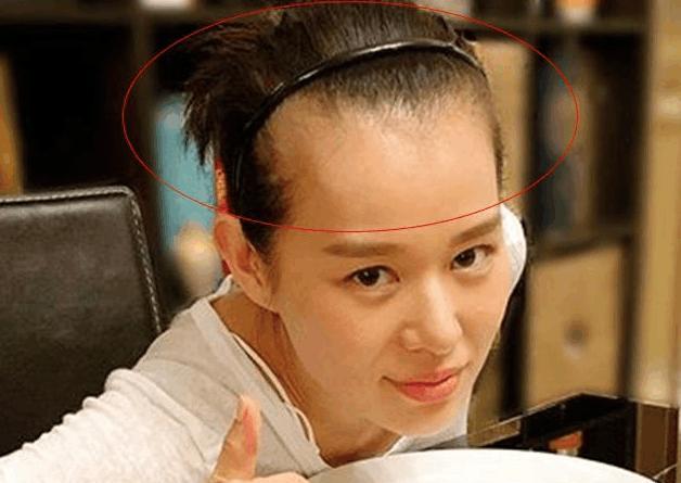 唐嫣孙俪天生高发际线, 胡杏儿产后脱发, 看到她后,网友不淡定了