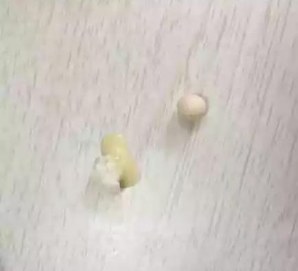 买火龙果,却发现里面有两颗蛋,真心猜不出来是