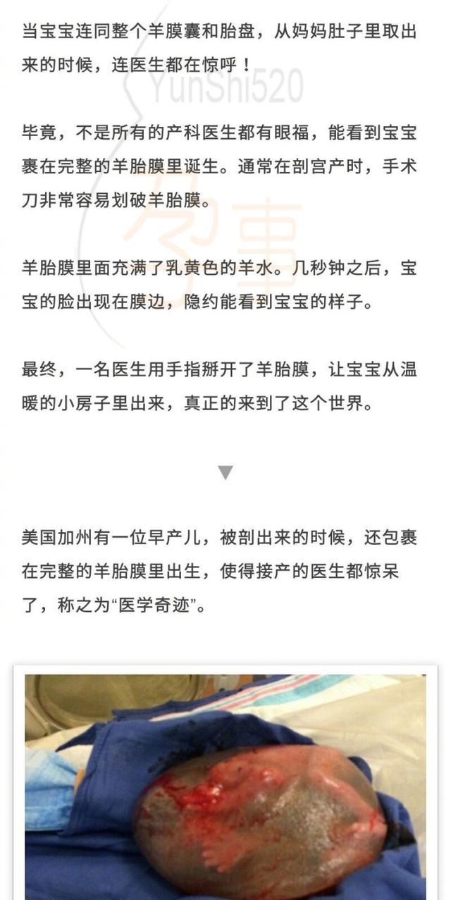 你见过和羊胎膜一起出生的孩子么?医生都惊了!据说这