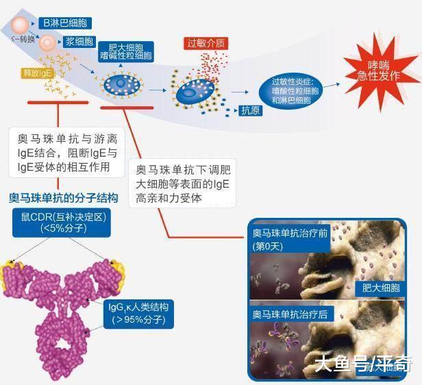 它堪比电影中格列宁, 是重症哮喘患者的后悔药