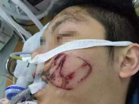 因本田销售赞CRV车好，就被东北车主划伤脸？