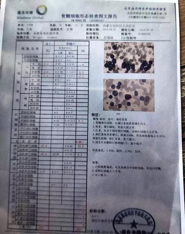 内蒙古一12岁女孩患急性淋巴细胞白血病,单亲妈妈无助