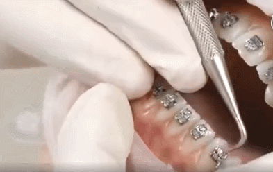 393_248 gif 动态图 动图