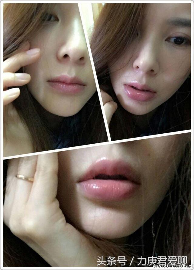 明星“削骨磨腮”成风尚：脸垮事业垮更快！她近照脸如同削掉一半