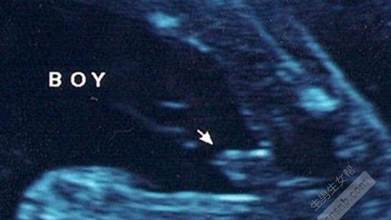 四维单子上有男女暗示 手把手交给您B超看男女