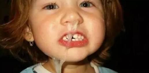 宝宝流鼻涕不一定是感冒!这三种止流鼻涕方法