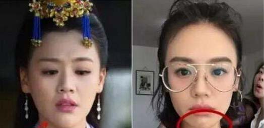 马思纯整容黑历史也被扒