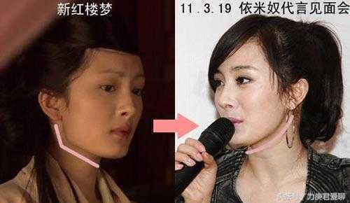 明星“削骨磨腮”成风尚：脸垮事业垮更快！她近照脸如同削掉一半