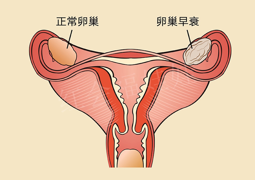 女性卵巢方面的疾病,你知道多少?