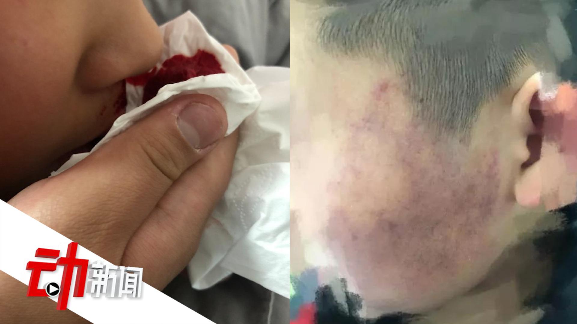初中老师打学生被调离岗位 多名家长联名请求老师“回归”