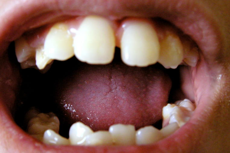 肾是人体最重要的排毒器官吗 cd80-inzcrxs7352576.png