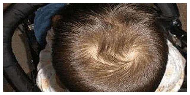 孩子头上旋的个数真的与性格有关吗?看完