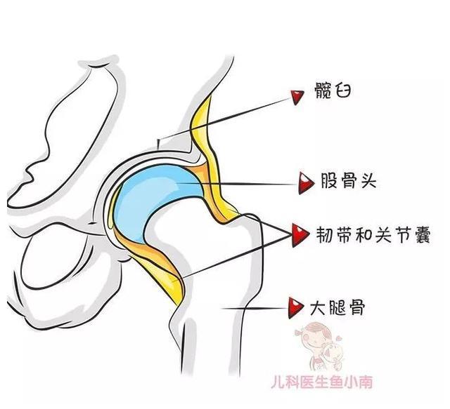 还有的宝宝股骨头,髋臼,韧带,关节囊和附近肌肉,有先天性发育不良或