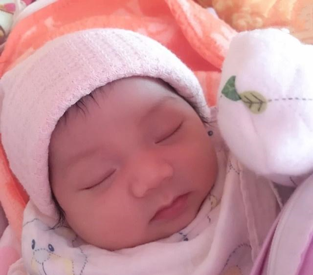 新生儿黄疸,是什么原因造成的都需要注意什么