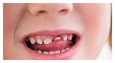 孩子经常吃这三种食物对牙齿健康有好处还能预防牙齿长歪